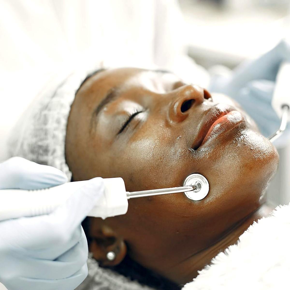 After body contouring showing improved silhouette