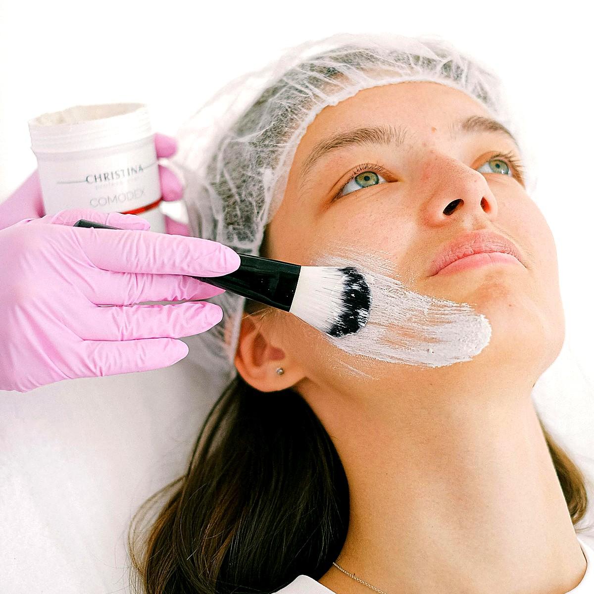 After chemical peel with brighter skin tone