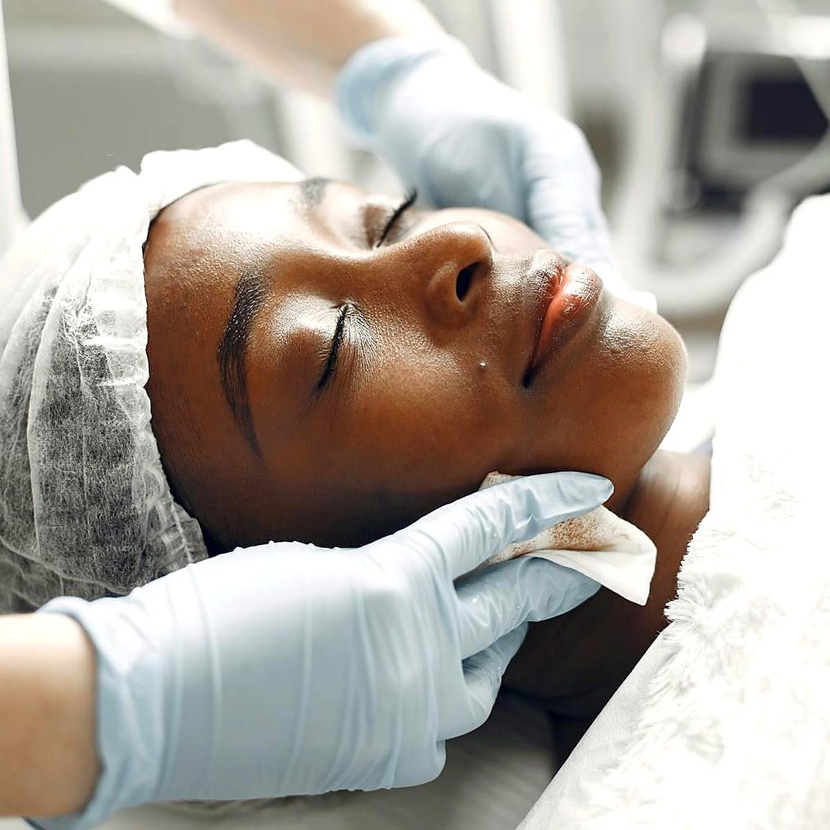 After skin resurfacing with refined skin surface