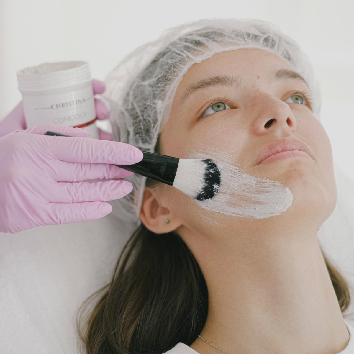 Before chemical peel for sun-related discoloration