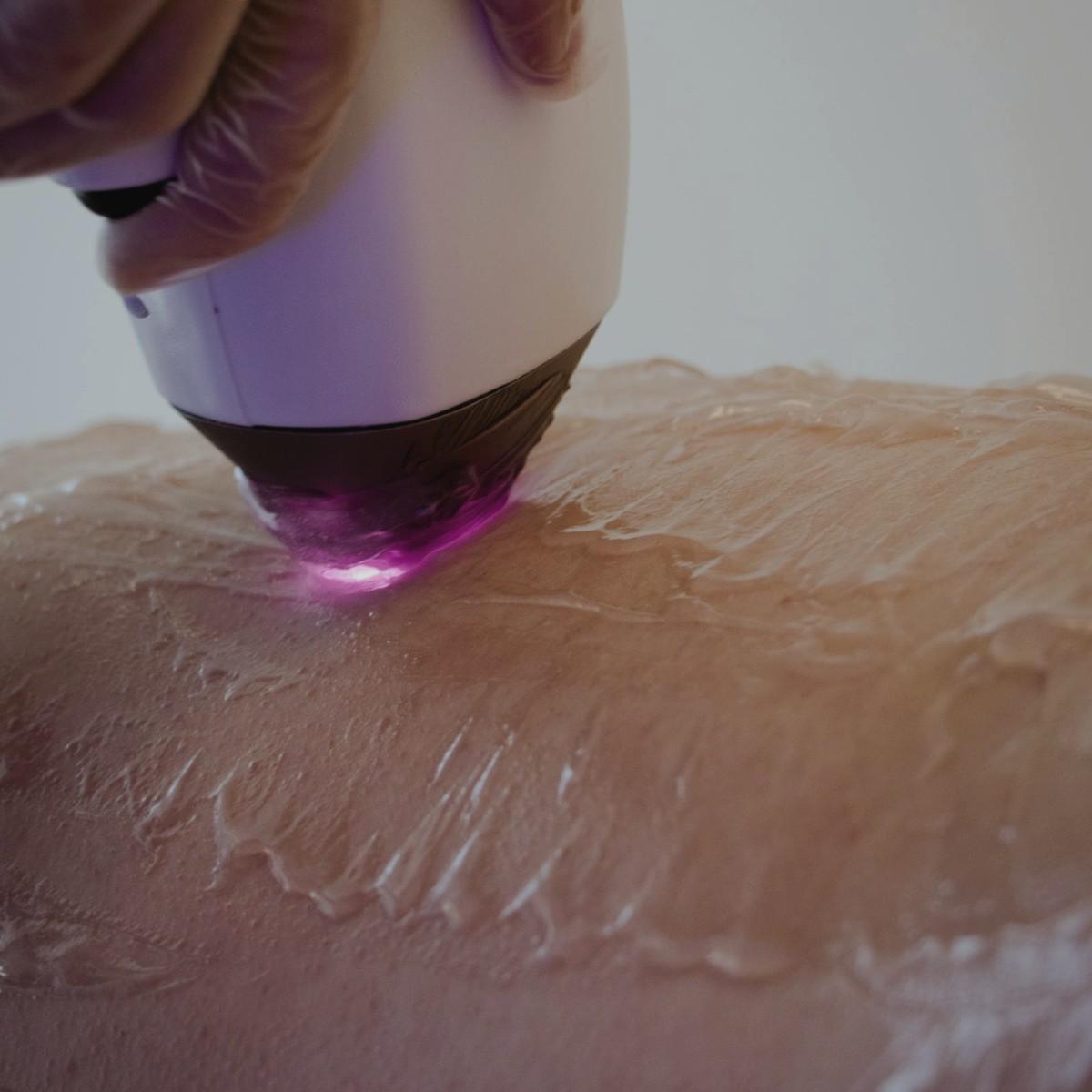 Before Hydrafacial with dry dull skin