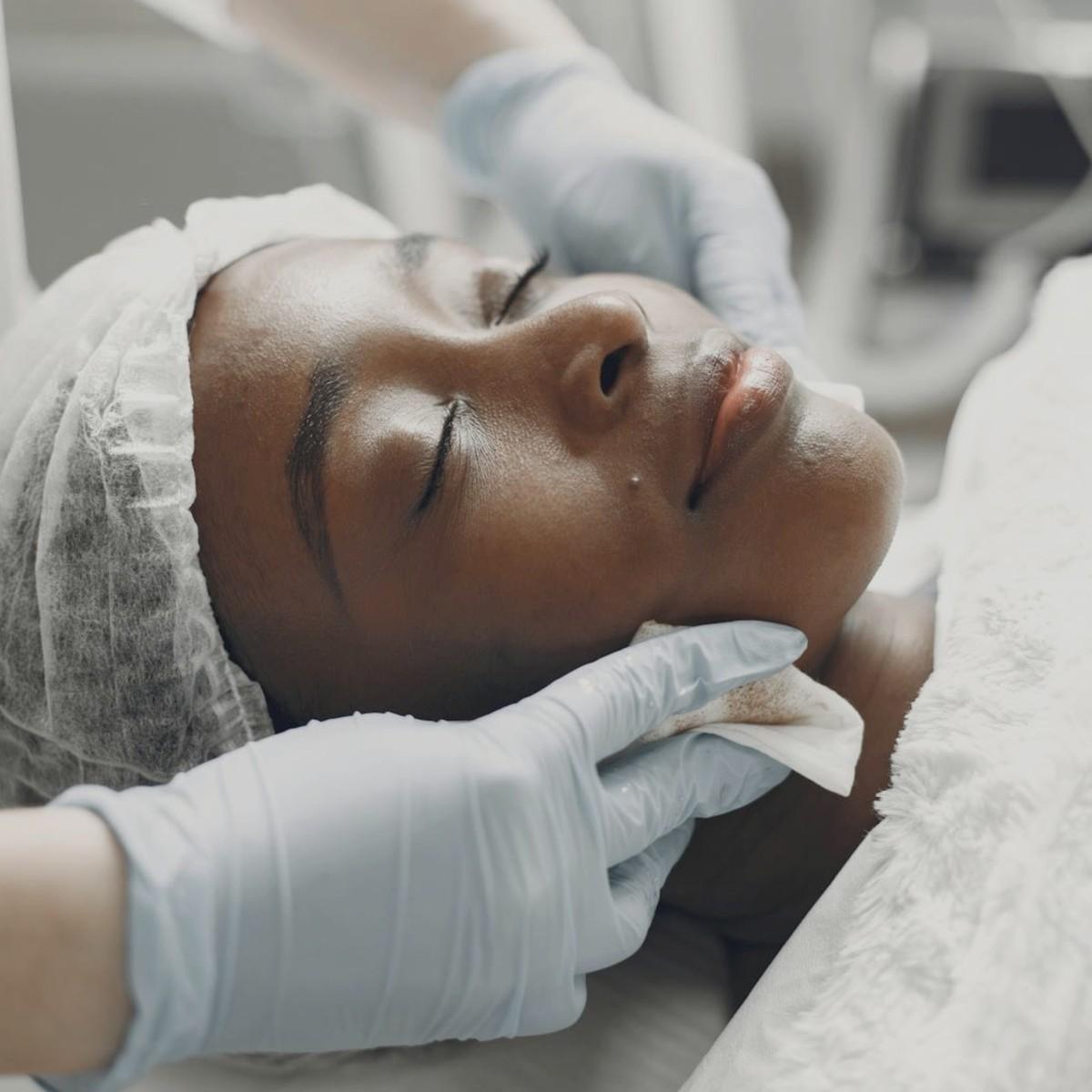 Before skin resurfacing with uneven texture