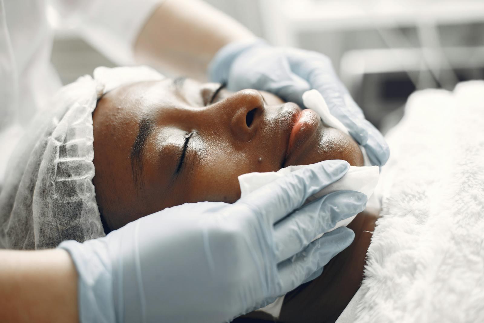 Chemical Peels treatment preview at TF Aesthetics & Med Spa